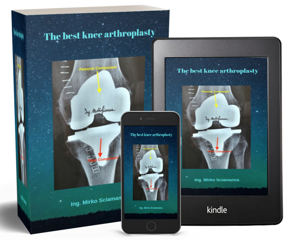 The Best Knee Arthroplasty