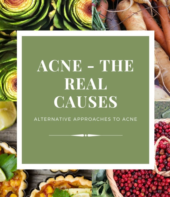 acne-real-causes