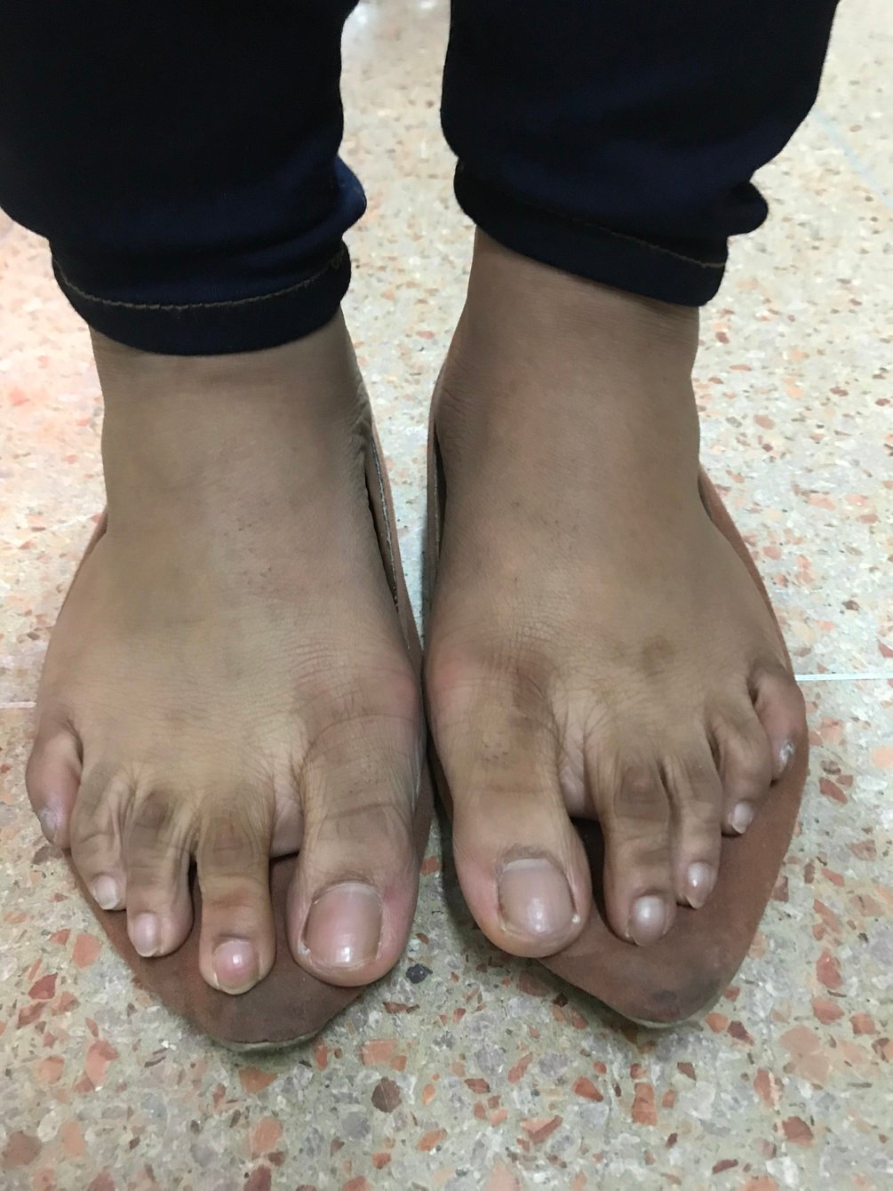 Size 9 SOLEInterview/FEETrub Of Bangladesh College FEET At Work
