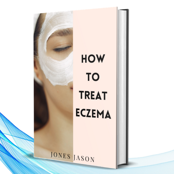 How To Treat Eczema (eBook + Free Audio Book)