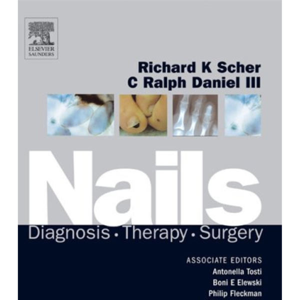 nails-diagnosis-therapy-surgery-third-edition