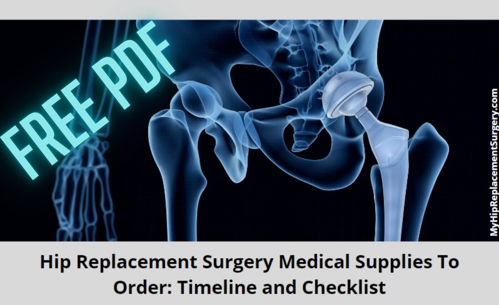 FREE PDF Hip Replacement Surgery Medical Supplies To Order Timeline
