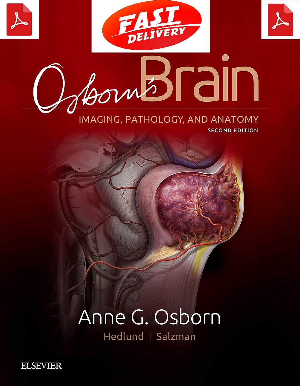 Osborn’s Brain imaging, pathology, and anatomy second Edition PDF
